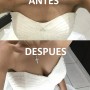 ESCOTE ANTES Y DESPUES